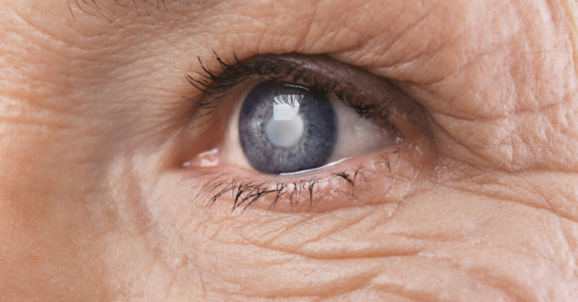 Image blog glaucome